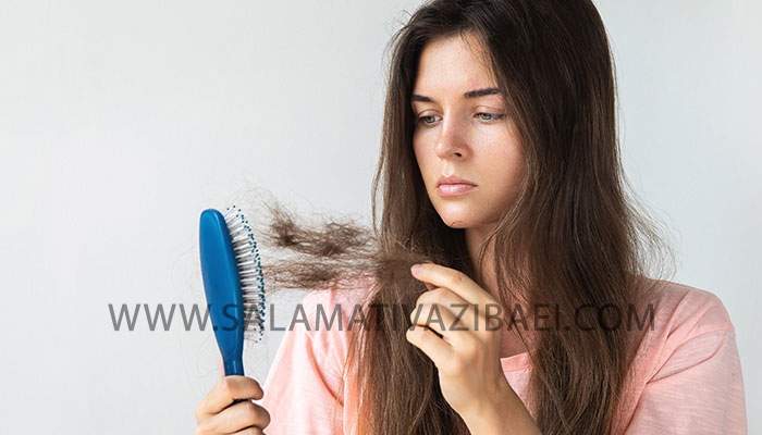 درمان ریزش مو در اثر کرونا
