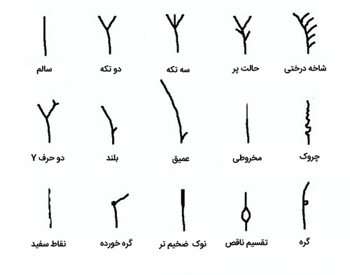 چه اشتباهاتی باعث ایجاد موخوره میشوند؟