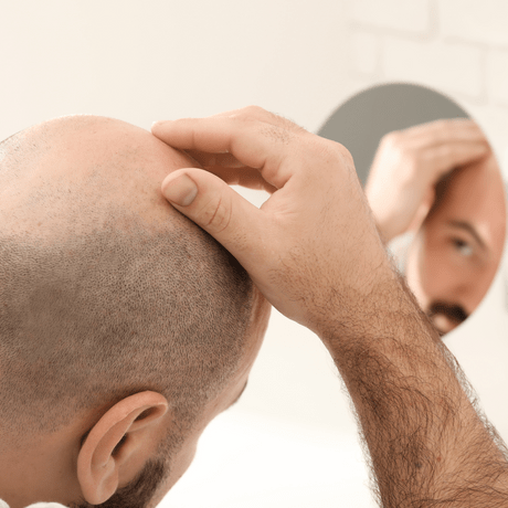 نحوه مراقبت از سر طاس و پوست سر بی مو