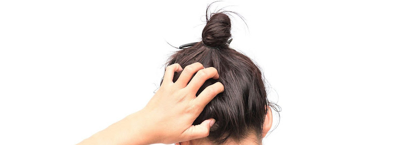 ترکاندن پوست سر یا ترکاندن مو چیست؟ خطرات و فواید ترکاندن پوست سر و مو