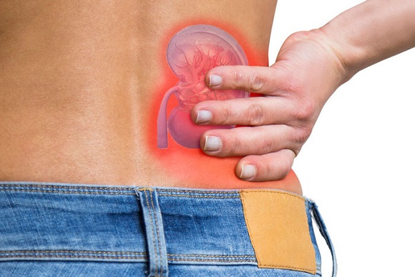 دلایل درد کلیه و حس آن،  درد کلیه در دوران بارداری و سنگ کلیه و هیدرونفروز چیست؟