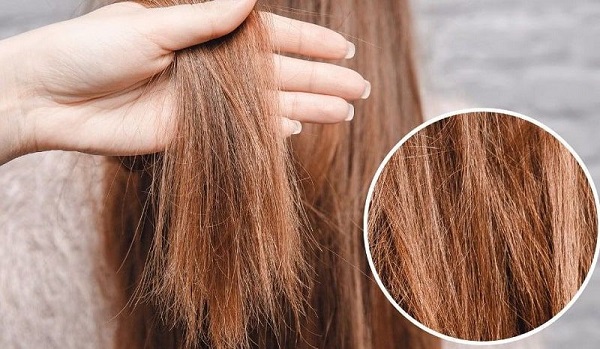 علل شایع شکستگی مو، ارتباط استرس و تیروئید و آسیب حرارتی با ریزش مو و نکاتی برای داشتن موهای سالم