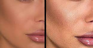 آرایش کیکی چیست؟ نحوه پیشگیری از آرایش کیکی