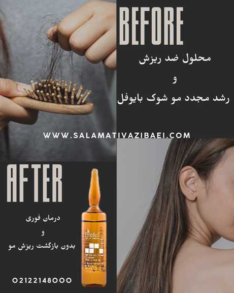 سرم ضد ریزش مو شوک